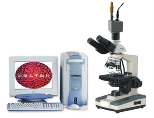 一滴血檢測(cè)儀全國(guó)最 一滴血檢測(cè)儀