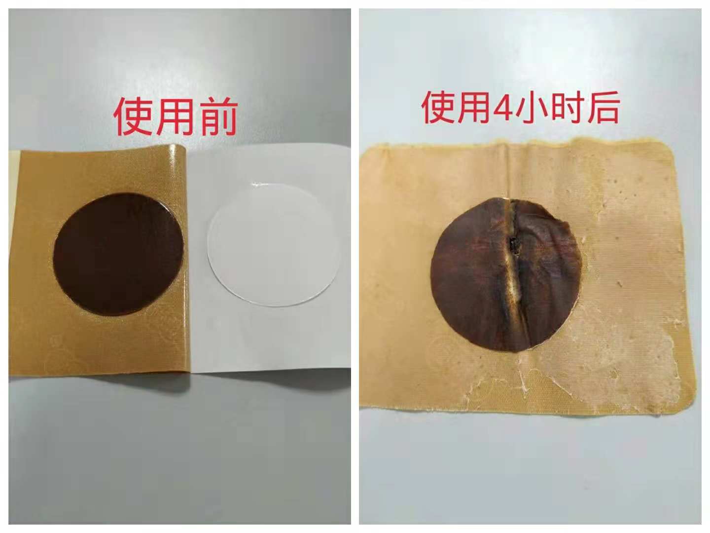 新型新款足貼 上病取下，百病治足