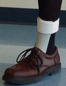 點(diǎn)擊放大 踝足矯形器-骨科耗材